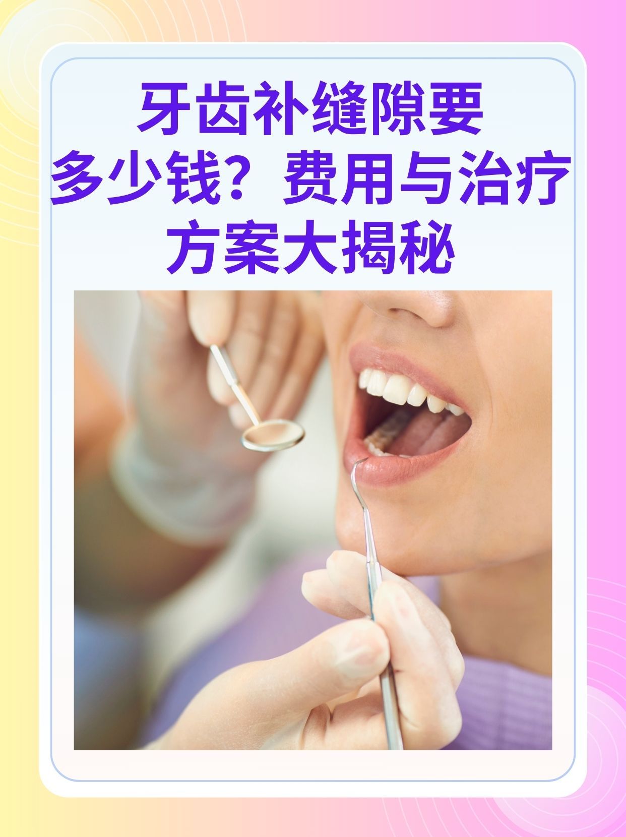 铁岭补牙医保可以报销吗(补牙医保可以报销吗 哪些可以报销呢)